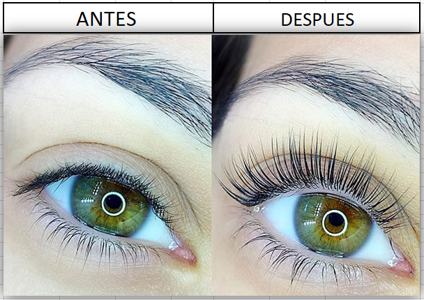 IMAGEN ANTES Y DESPUES